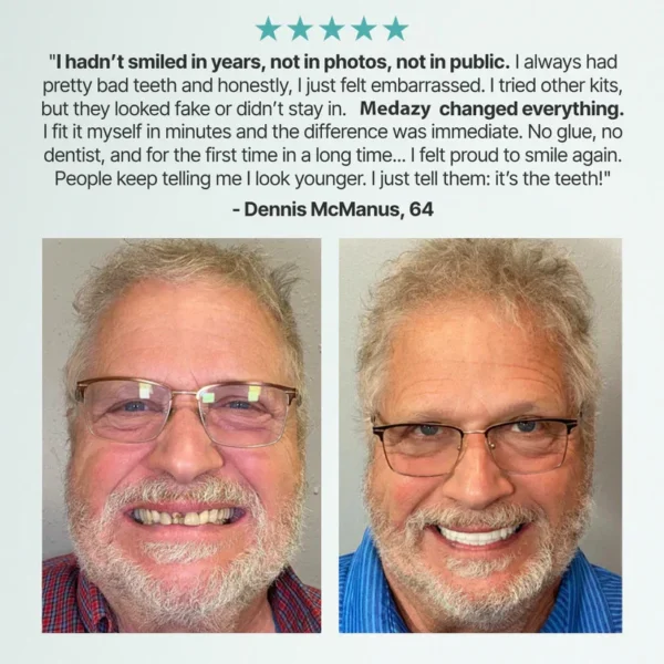 Ends Today: 70% OFF!Medazy Custom-Fit Full Functional Dentures Make you more confident - Image 9